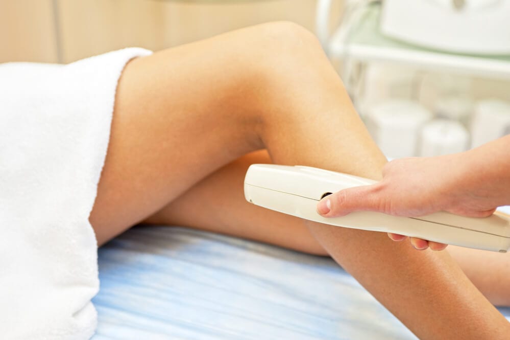 Laser Hair Removal Procedure in Woman's Legs