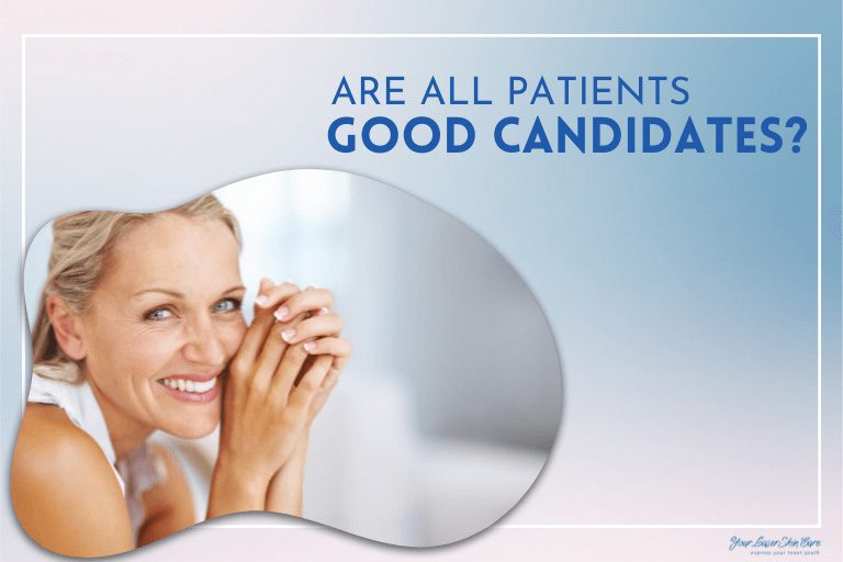Coolsculpting Candidates