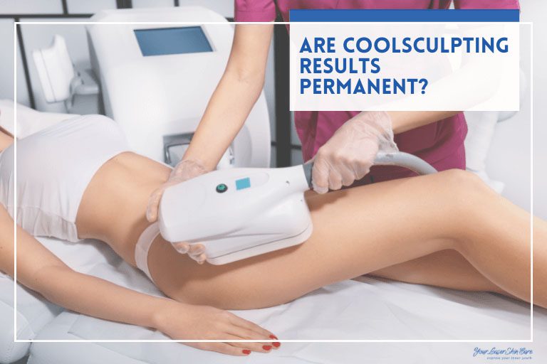 Are CoolSculpting results permanent?