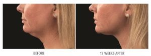 Neck
