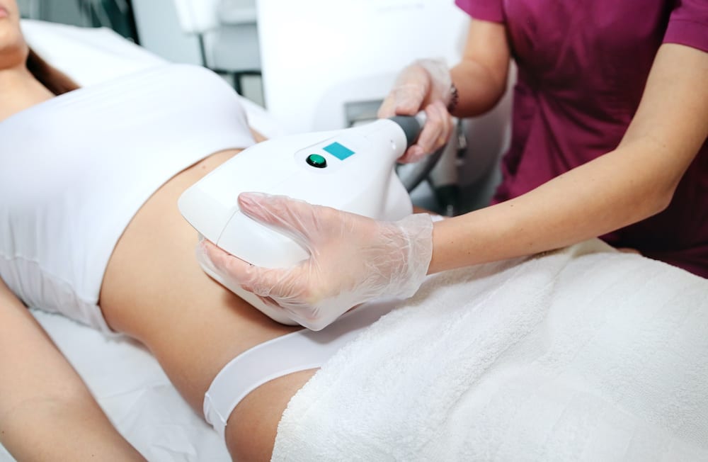 CoolSculpting