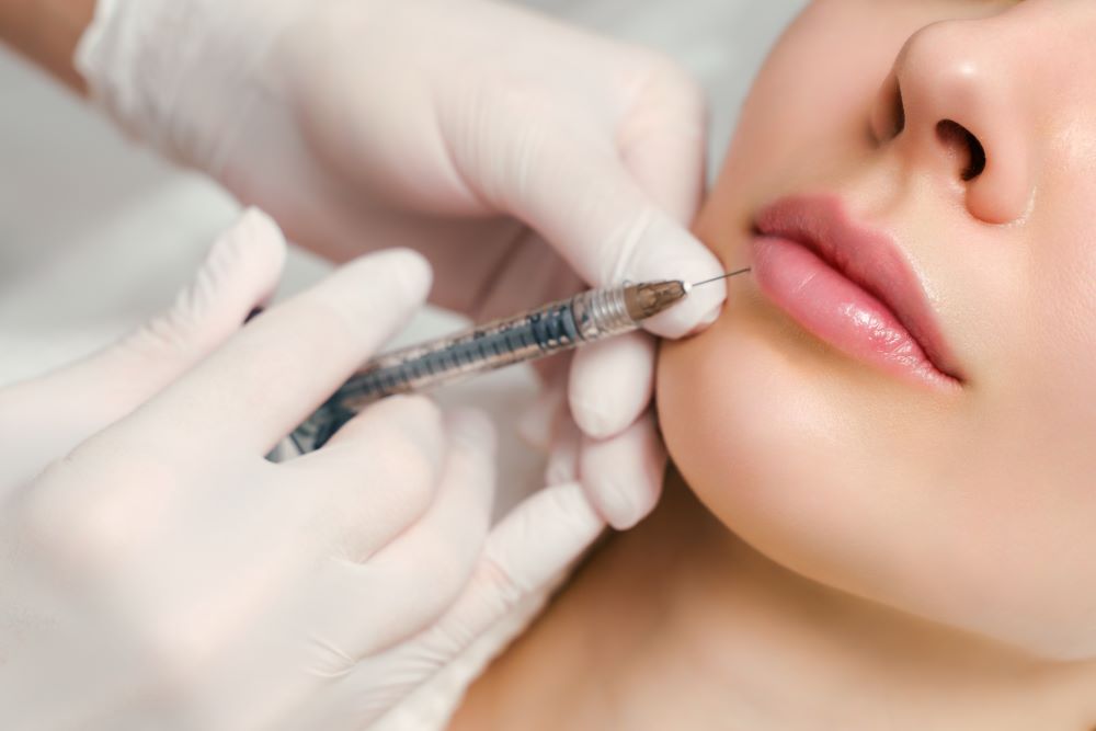 A woman receiving a Juvederm lip filler treatment.