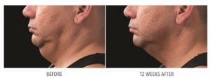 Neck