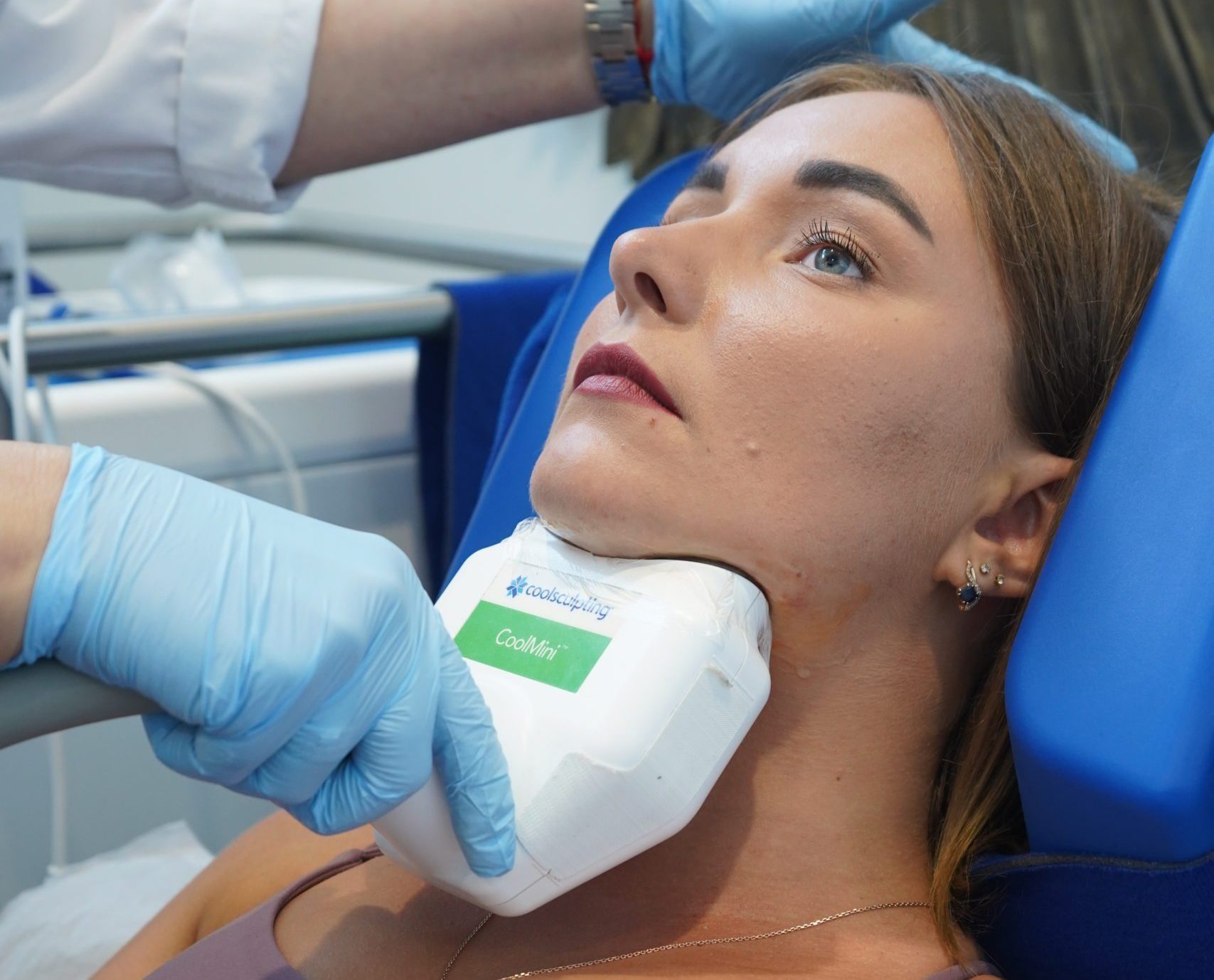 Woman getting CoolSculpting done on her chin in Los Angeles