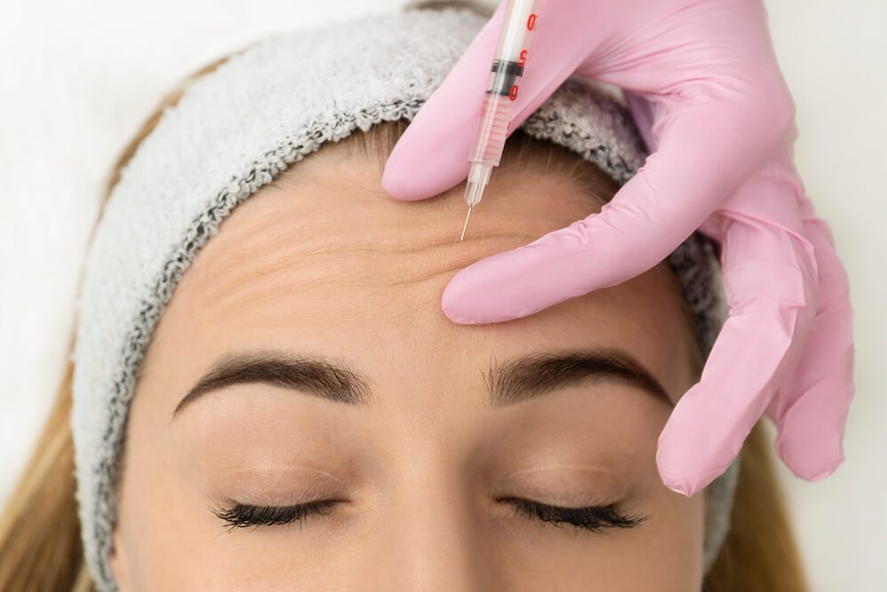 woman getting botox to prevent further definition of wrinkles in her forehead
