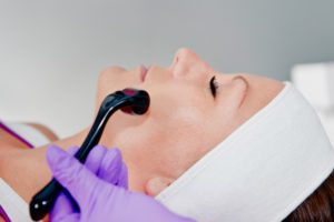 woman getting microneedling done in los angeles
