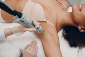 woman receiving laser hair removal on her underarm