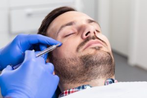 man getting under eye filler in los angeles