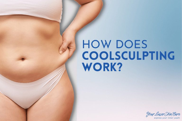 How Does CoolSculpting Work?