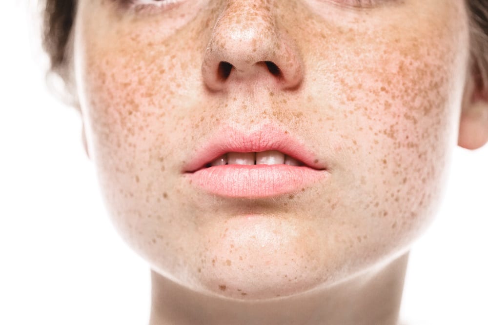Woman's face with freckles