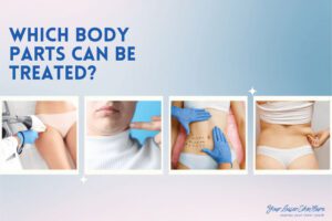 Body Parts Treated with Coolsculpting